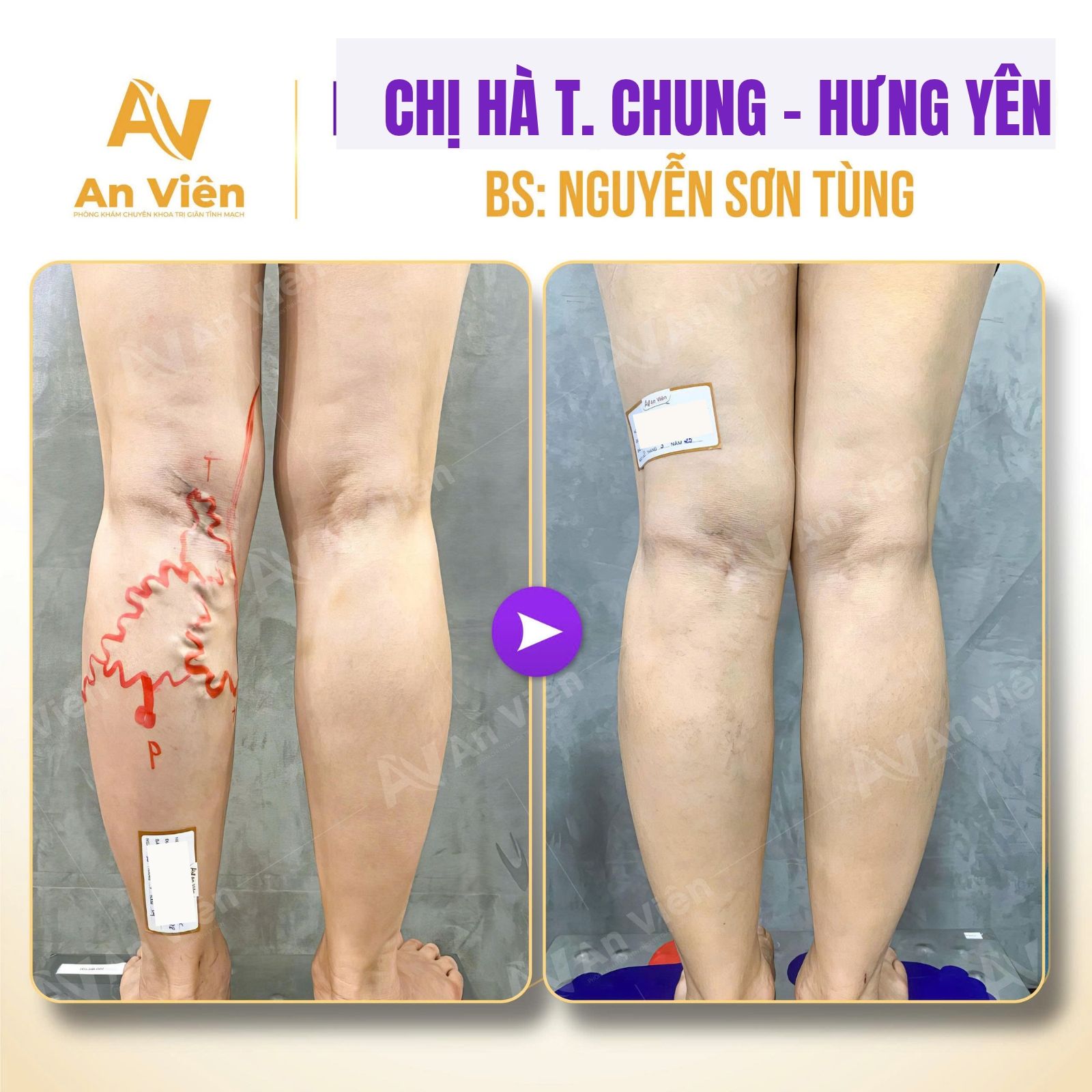 An Viên