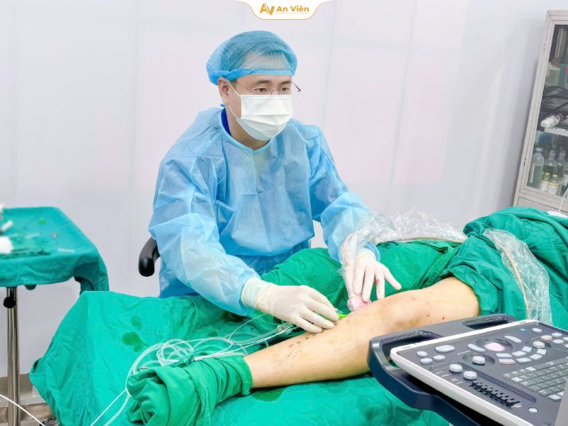 Điều trị bằng Laser EVLA