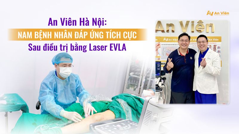 Điều trị bằng Laser EVLA