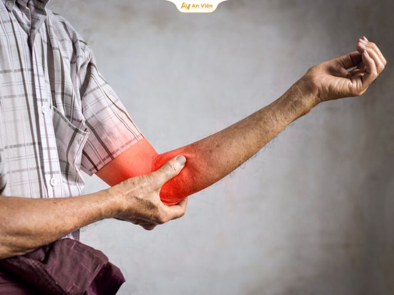 6 dấu hiệu giãn tĩnh mạch khuỷu tay không nên chủ quan 8 Giãn tĩnh mạch khuỷu tay