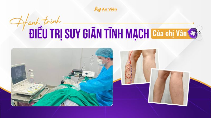 Hành trình điều trị suy giãn tĩnh mạch