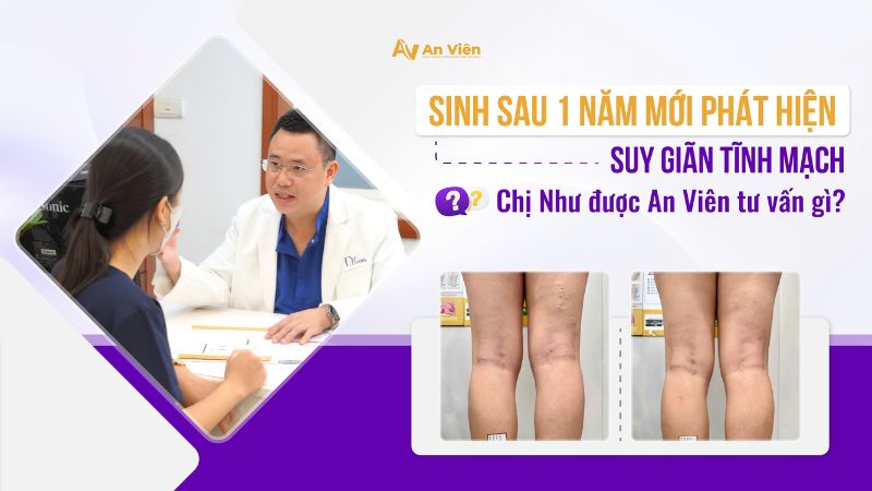 Sau sinh 1 năm mới phát hiện giãn tĩnh mạch, chị Như được bác sĩ An Viên tư vấn gì? 8 Phát hiện giãn tĩnh mạch