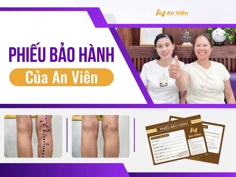 Phiếu bảo hành của An Viên