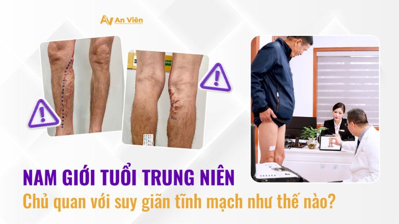 Nam giới tuổi trung niên chủ quan với suy giãn tĩnh mạch như thế nào? 7 Suy giãn tĩnh mạch