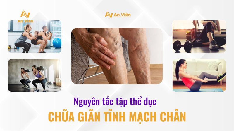 Nguyên tắc tập thể dục chữa giãn tĩnh mạch chân 18 Tập thể dục chữa giãn tĩnh mạch chân