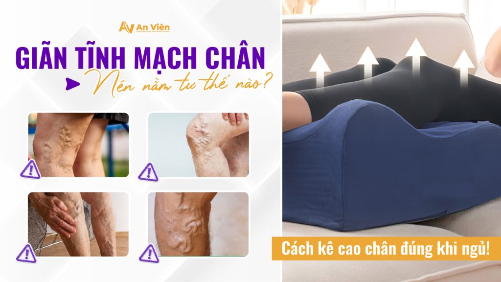 Giãn tĩnh mạch chân nên nằm tư thế nào? Cách kê cao chân đúng khi ngủ 13 an vien 2 1