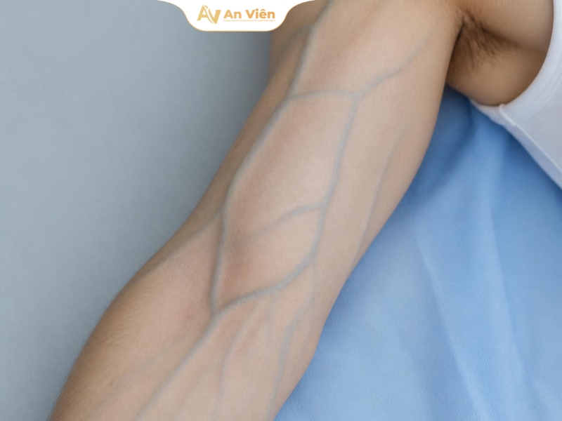 Tĩnh mạch cánh tay đầu là gì? Các bệnh lý phổ biến thường gặp 6 an-vien