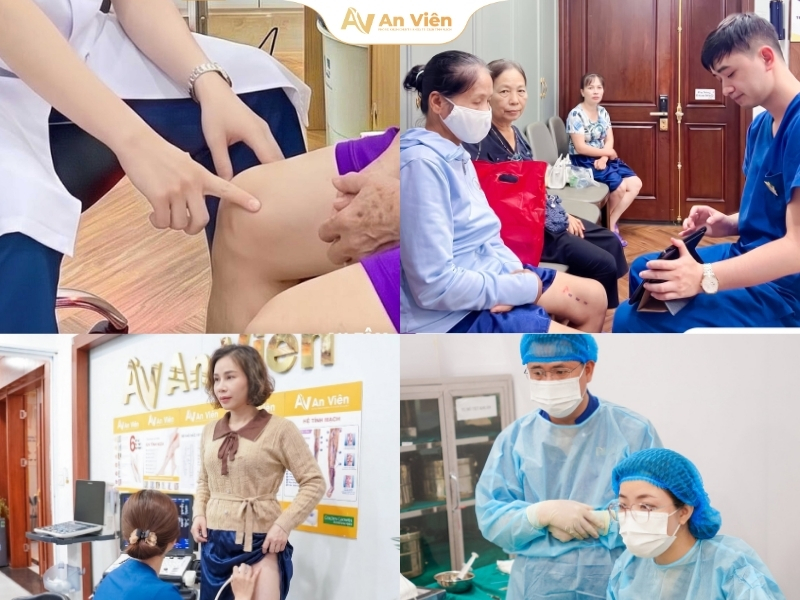 benh-suy-gian-tinh-mach-tai-an-vien