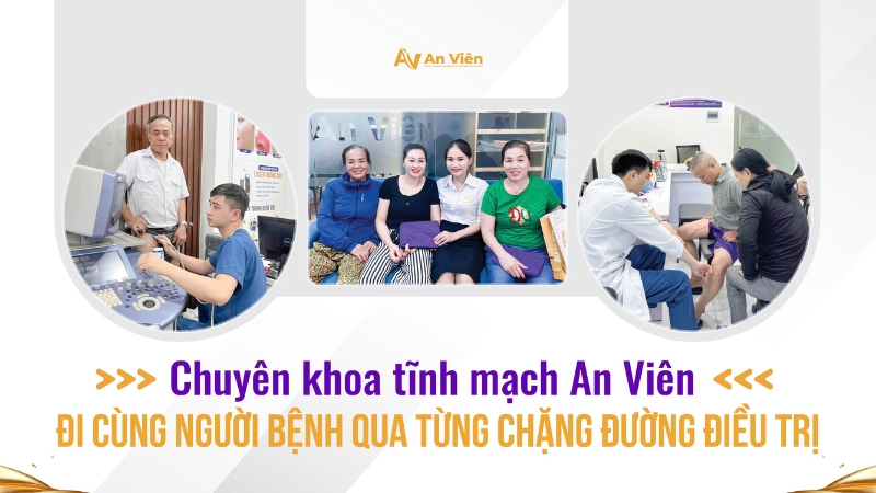 Chuyên khoa tĩnh mạch An Viên đi cùng người bệnh qua từng chặng đường điều trị 20 dieu tri suy gian tinh mach tai an vien 4